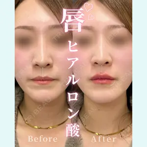 ルラ美容クリニック 大宮院 右京 大季医師の症例