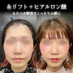 eクリニック 大阪院 脇谷 雄一朗医師の症例