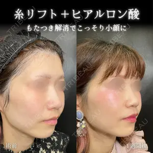 eクリニック 大阪院 脇谷 雄一朗医師の症例