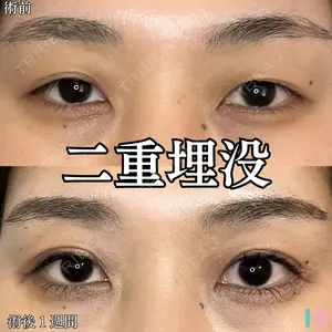 形成外科と美容外科のクリニック池袋 春日 航医師の症例