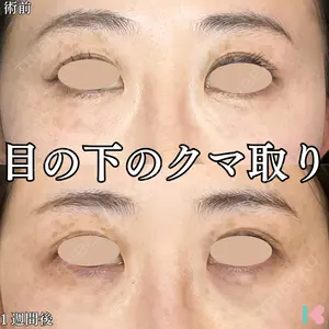 形成外科と美容外科のクリニック池袋の症例