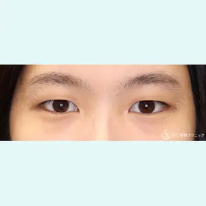 聖心美容クリニック 六本木院 綾部 奈々子医師の症例