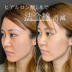 ルラ美容クリニック 大宮院 右京 大季医師の症例