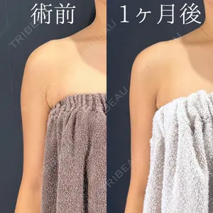 HAAB×DREAM BEAUTY CLINIC 大阪梅田院 鈴木 馨斗医師の症例