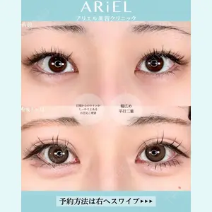 アリエル美容クリニック 大宮院 鈴木　桂介医師の症例