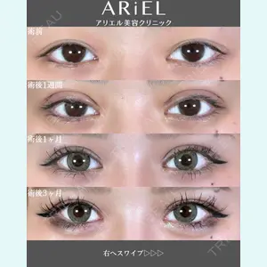 アリエル美容クリニック 郡山院 安齋 誠基医師の症例