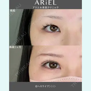 アリエル美容クリニック 郡山院 安齋 誠基医師の症例