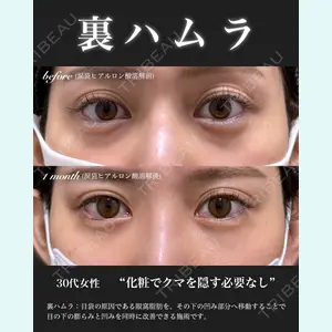 EMMO FACE CLINIC 大宮院 百瀬 直也医師の症例