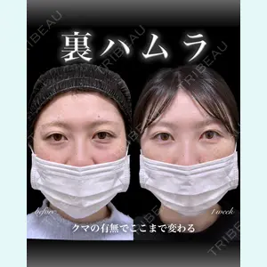 EMMO FACE CLINIC 大宮院 百瀬 直也医師の症例