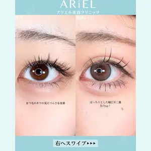 アリエル美容クリニック 大宮院 鈴木　桂介医師の症例