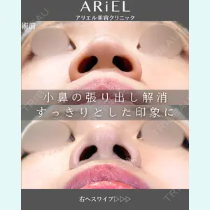 アリエル美容クリニック 郡山院 安齋 誠基医師の症例