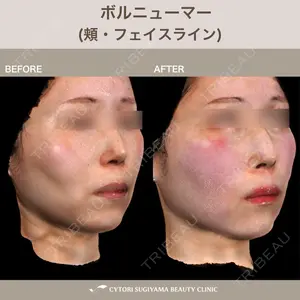 サイトリ杉山美容クリニックの症例