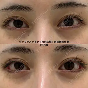 エターナル美容クリニック 久門田 詳医師の症例