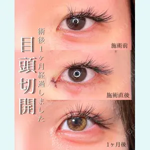 症例