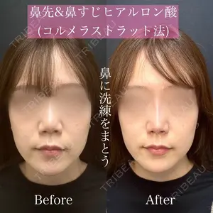 ルラ美容クリニック 渋谷本院 昼間 路子医師の症例