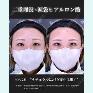 EMMO FACE CLINIC 大宮院 百瀬 直也医師の症例