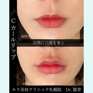ルラ美容クリニック 札幌院 能登 貴弘医師の症例