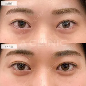 A CLINIC（エークリニック） 福岡院 小林 直樹医師の症例
