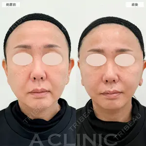A CLINIC（エークリニック） 福岡院 小林 直樹医師の症例