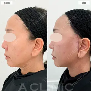 A CLINIC（エークリニック） 福岡院 小林 直樹医師の症例