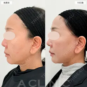 A CLINIC（エークリニック） 福岡院 小林 直樹医師の症例