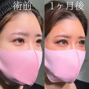 症例