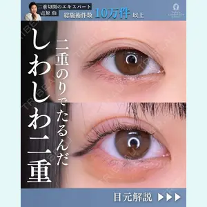 症例