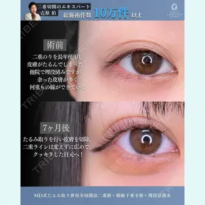 症例