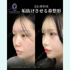 症例