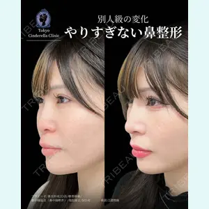 症例