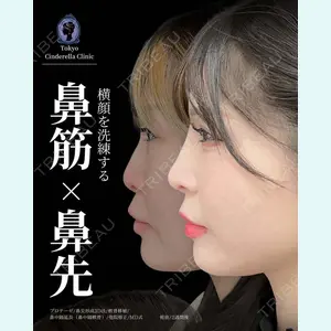 症例