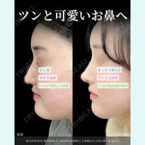 症例