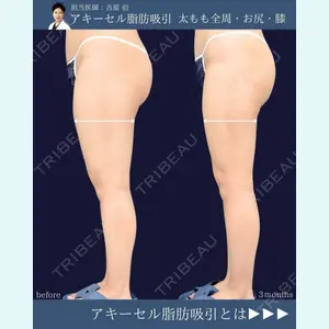 症例