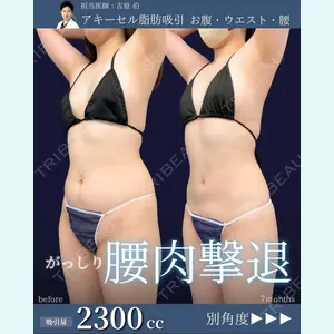 症例