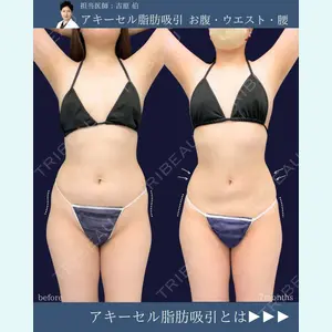 症例
