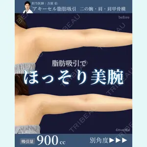 症例