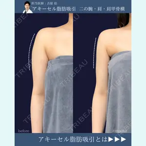 症例