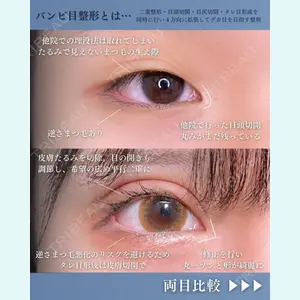症例