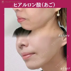 ギャラリークリニック 銀座の症例