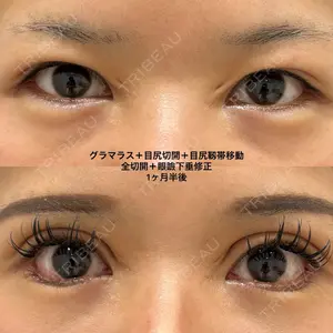 エターナル美容クリニック 久門田 詳医師の症例