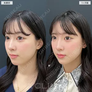 A CLINIC（エークリニック） 池袋院 三橋 克之医師の症例