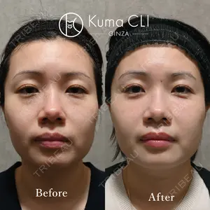 Kuma CLI 【クマクリ】 毛利 理人医師の症例