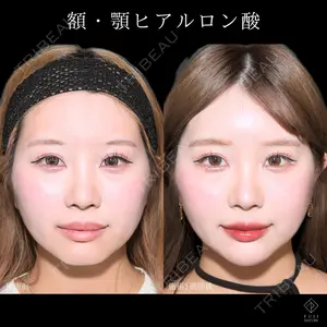 症例