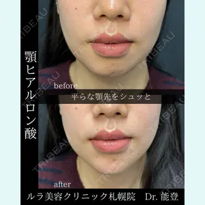 ルラ美容クリニック 札幌院 能登 貴弘医師の症例