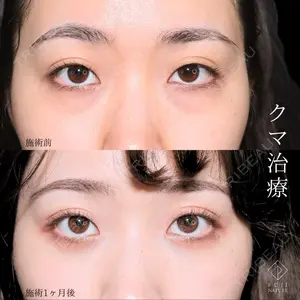 症例