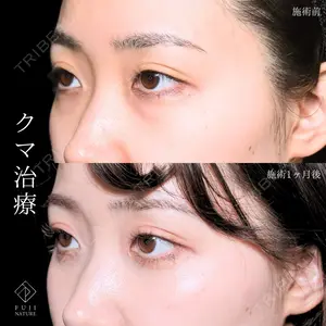 症例