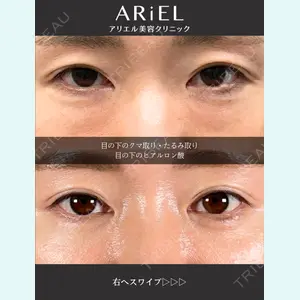 アリエル美容クリニック 大宮院 鈴木　桂介医師の症例