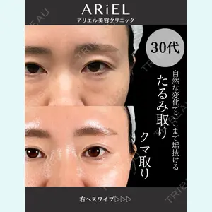 アリエル美容クリニック 大宮院 鈴木　桂介医師の症例