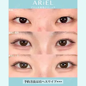 アリエル美容クリニック 大宮院 鈴木　桂介医師の症例