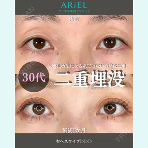 アリエル美容クリニック 大宮院 鈴木　桂介医師の症例